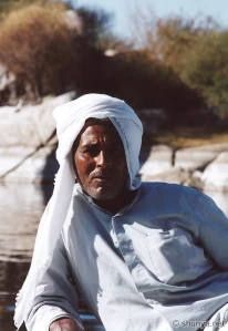 An Egyptian man with the amrani/mariin phenotype