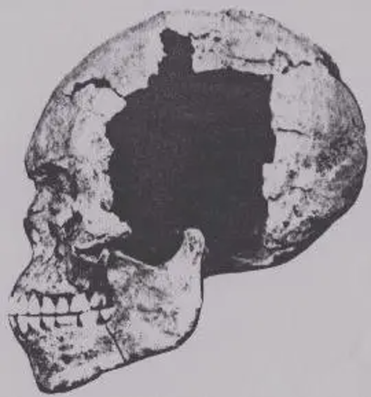 A Mesolithic period "Negroid" skull excavated in Wadi Halfa, Sudan. The specimen is believed to be ancestral to the local Nilotic populations, as it closely resembles the crania of modern Nilo-Saharan/Niger-Congo peoples. Note the marked prognathism (facial projection). This is a common trait of Nilotes and other African "Negroes," who have a prognathous average of 104.4 on the gnathic index (alveolar index) (cf. Lockyer (1910)).